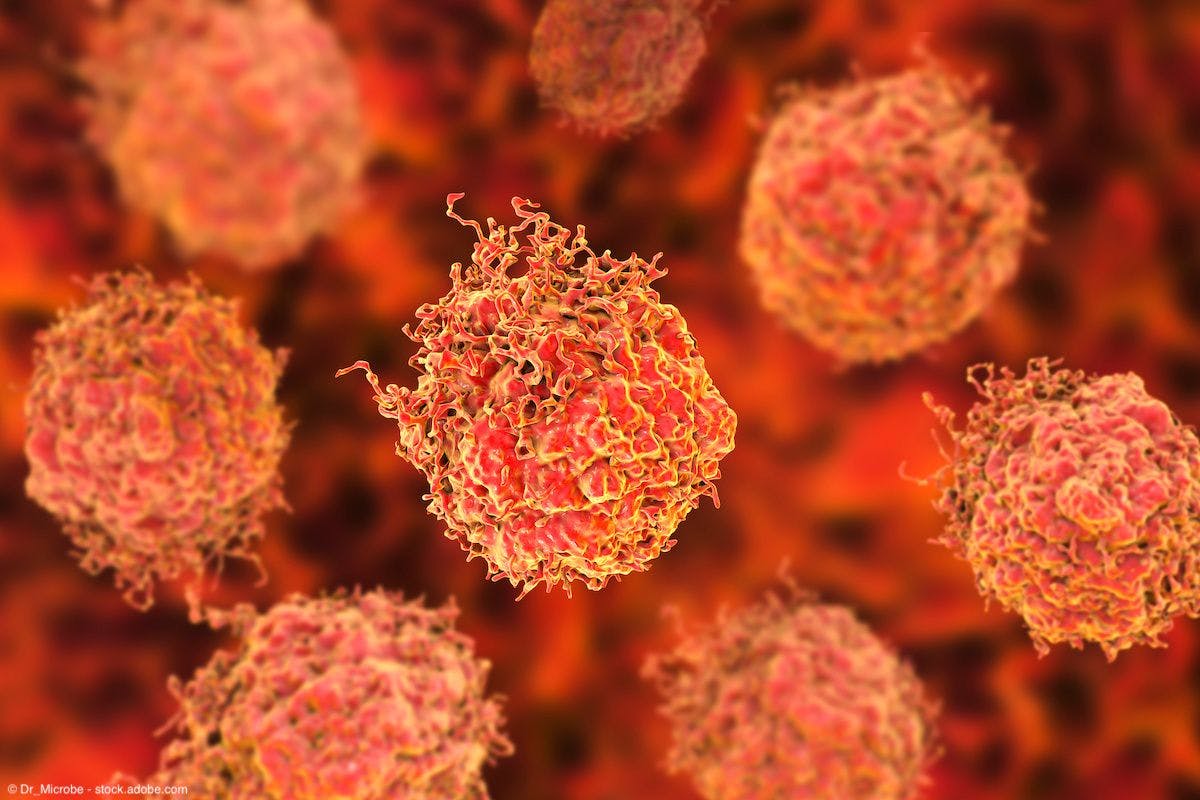 CAR T-cell therapy explored as potential option for advanced renal cell carcinoma